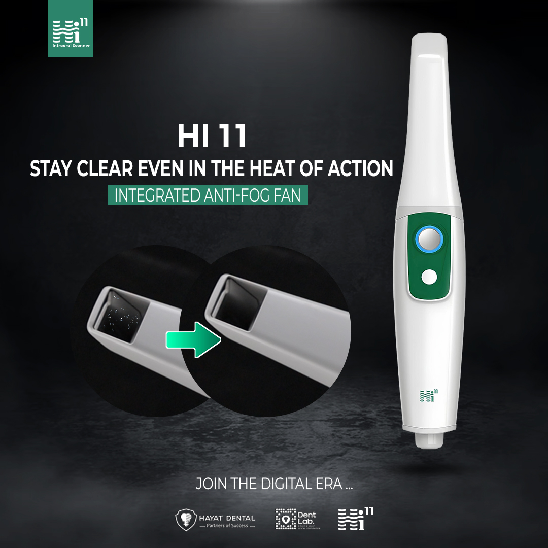 Hi11 Intraoral Scanner